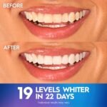Crest Teeth Whitening Strips, Crest 3D Whitestrips Professional Effects, Enamel Safe Teeth Whitening Kit, 22 Treatments (44 Strips), Professional-Level Whitening, 19 Levels Whiter